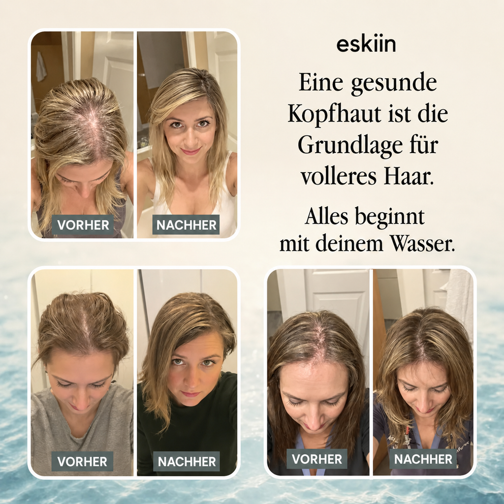 Eskiin